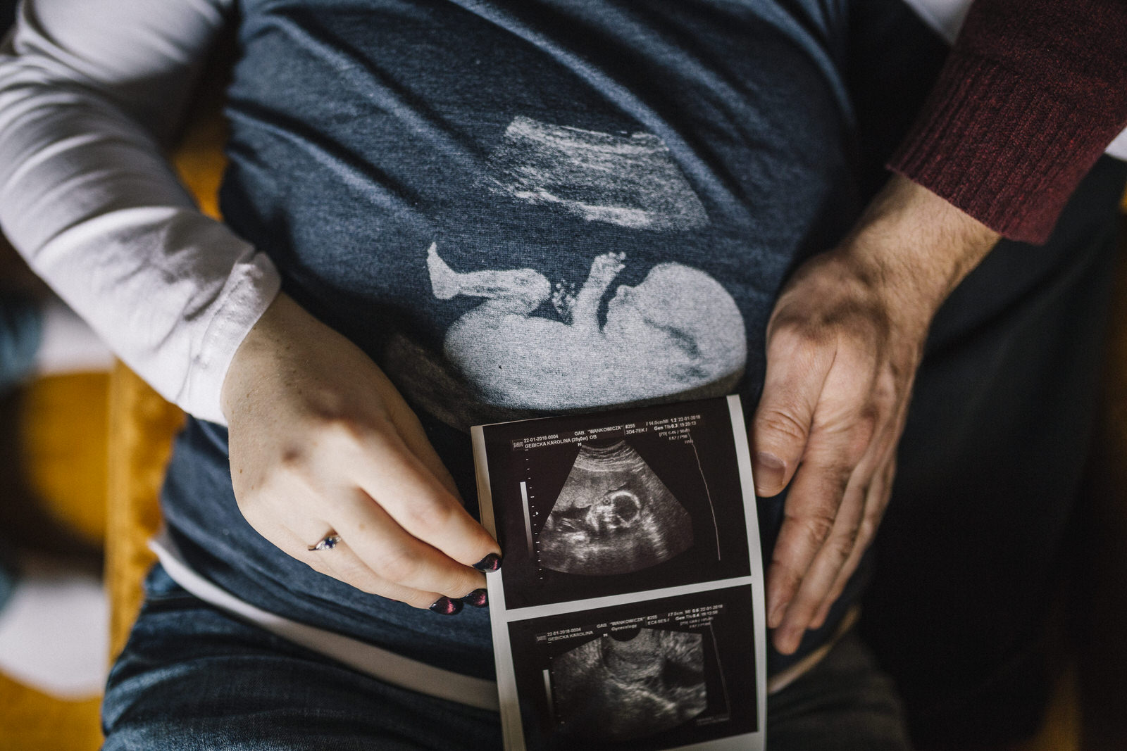 sesja ciazowa warszawa